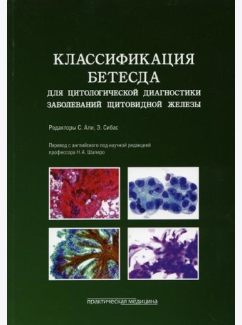 Классификация Бетесда для цитологической диагностики заболеваний щитовидной железы: терминология, критерии и пояснения