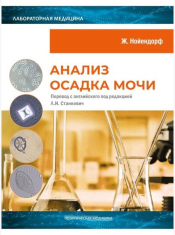 Анализ осадка мочи