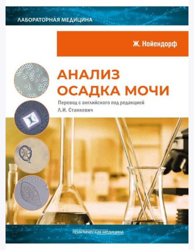 Анализ осадка мочи