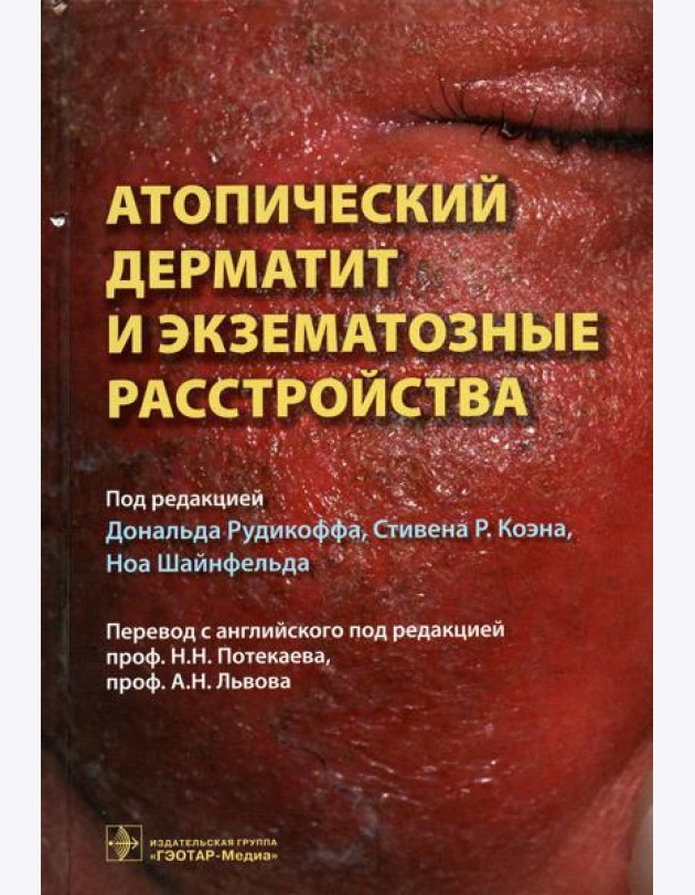 Атопический дерматит и экзематозные расстройства