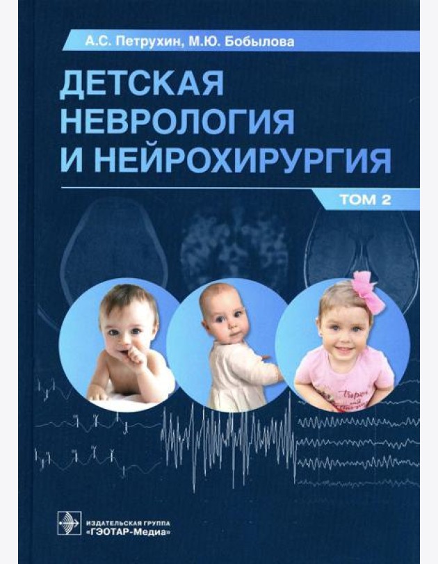 Детская неврология и нейрохирургия: Учебник. В 2 т. Т. 2
