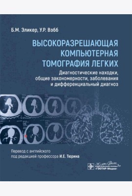 Высокоразрешающая компьютерная томография легких. Диагностические находки, общие закономерности, заболевания и дифференциальный диагноз