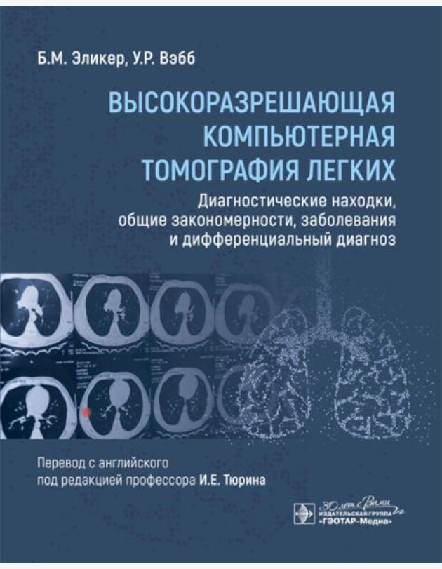 Высокоразрешающая компьютерная томография легких. Диагностические находки, общие закономерности, заболевания и дифференциальный диагноз