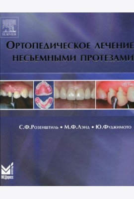 Ортопедическое лечение несъемными протезами