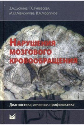 Нарушения мозгового кровообращения: диагностика, лечение, профилактика