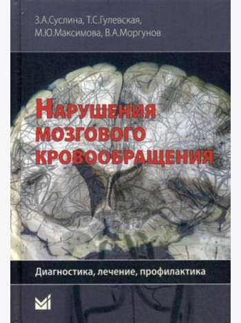 Нарушения мозгового кровообращения: диагностика, лечение, профилактика