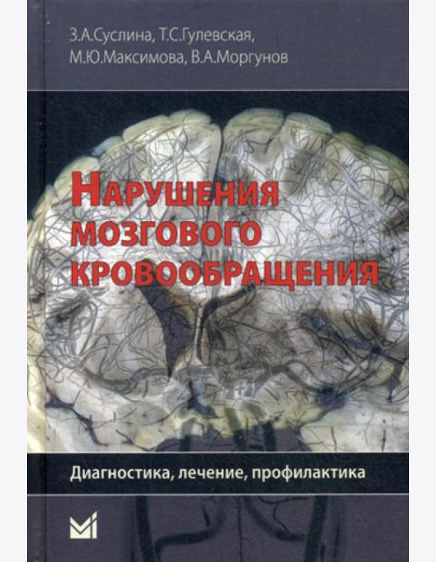 Нарушения мозгового кровообращения: диагностика, лечение, профилактика