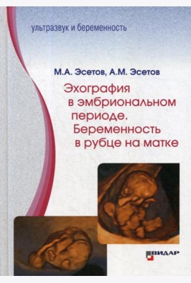 Эхография в эмбриональном периоде. Беременность в рубце на матке