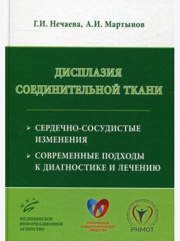Дисплазия соединительной ткани: сердечно-сосудистые изменения, современные подходы к диагностике и лечению