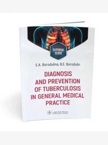 Diagnosis and prevention of tuberculosis in general medical practice: tutorial guide = Диагностика и профилактика туберкулеза в общей врачебной практи