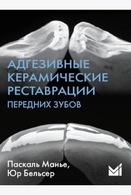 Адгезивные керамические реставрации передних зубов. 4-е изд