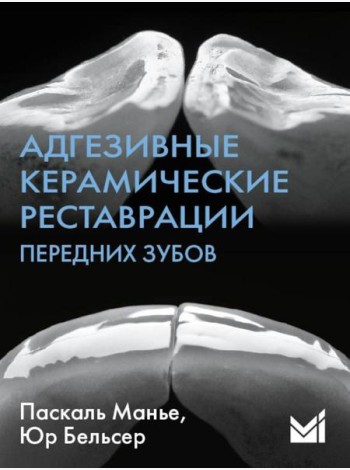 Адгезивные керамические реставрации передних зубов. 4-е изд