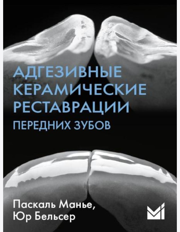 Адгезивные керамические реставрации передних зубов. 4-е изд