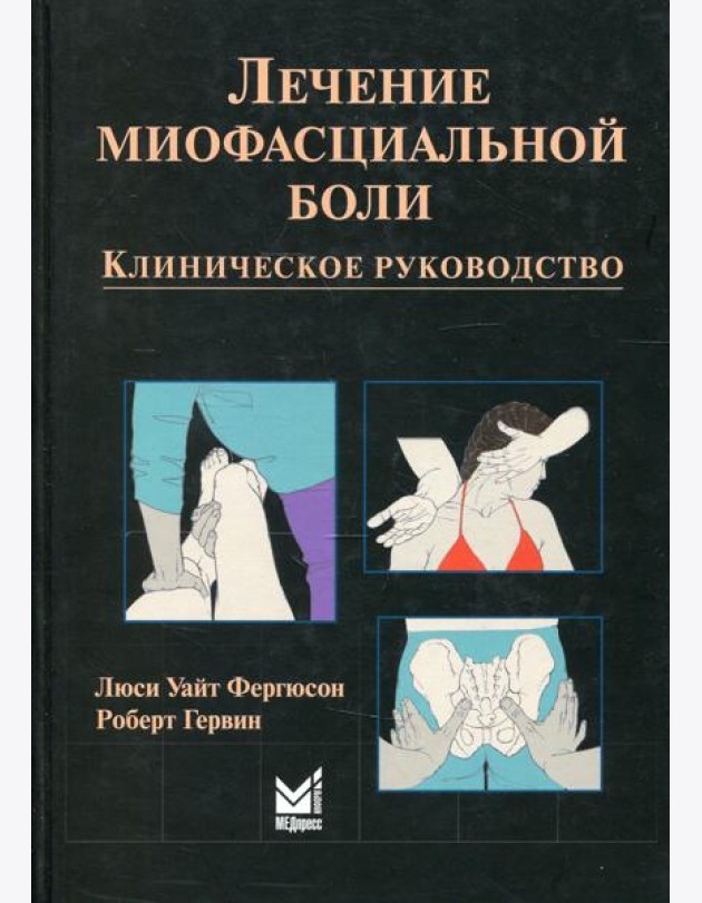 Лечение миофасциальной боли