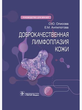 Доброкачественная лимфоплазия кожи: руководство для врачей