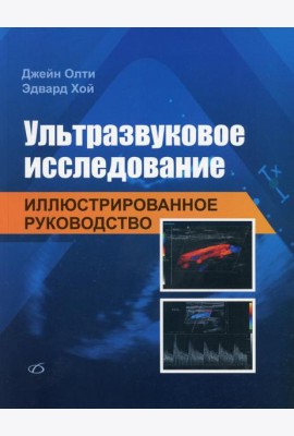 Ультразвуковое исследование. Иллюстрированное руководство
