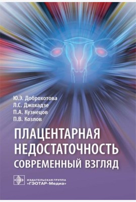 Плацентарная недостаточность. Современный взгляд