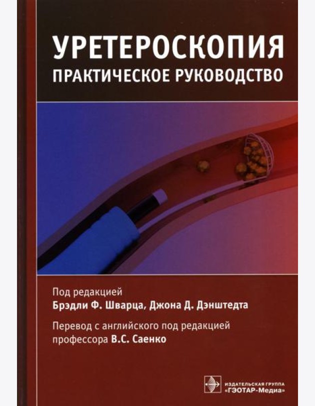 Уретероскопия: практическое руководство