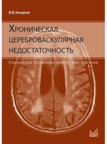 Хроническая цереброваскулярная недостаточность. 4-е изд., перераб.и доп