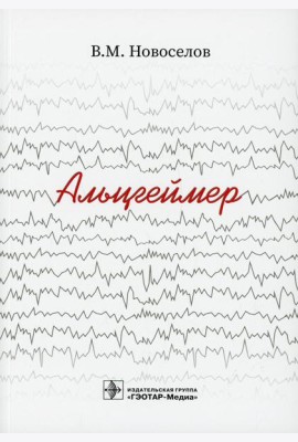 Альцгеймер