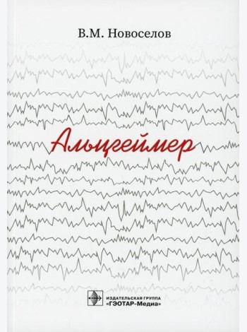 Альцгеймер