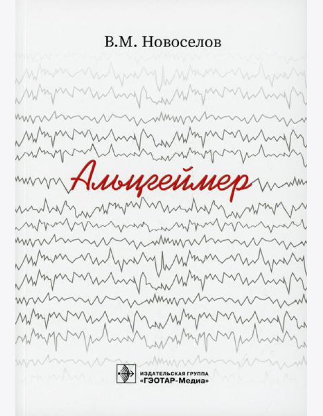 Альцгеймер