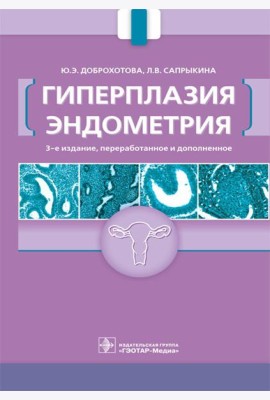 Гиперплазия эндометрия. 3-е изд., перераб. и доп