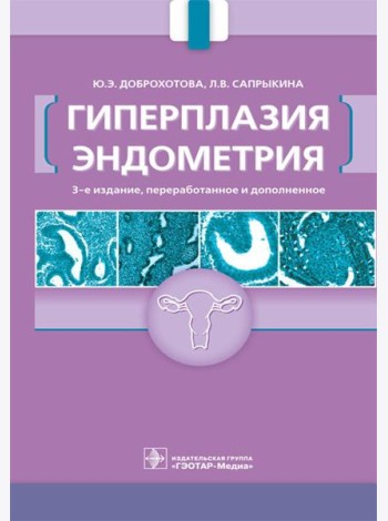 Гиперплазия эндометрия. 3-е изд., перераб. и доп