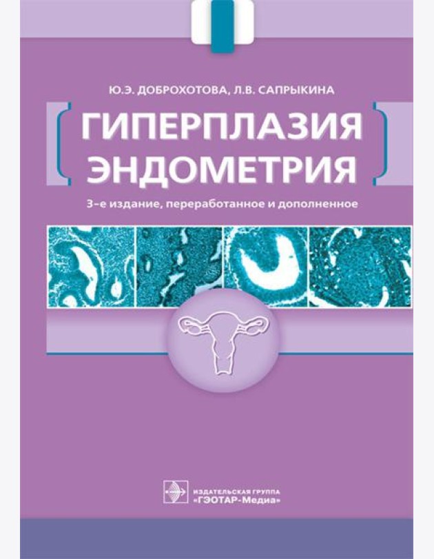Гиперплазия эндометрия. 3-е изд., перераб. и доп