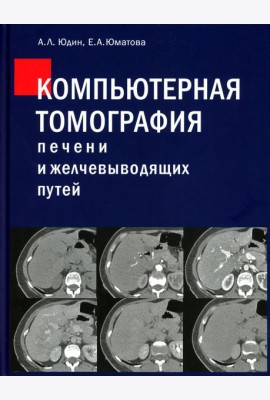 Компьютерная томография печени и желчевыводящих путей: практическое руководство