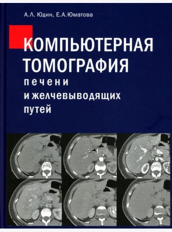 Компьютерная томография печени и желчевыводящих путей: практическое руководство