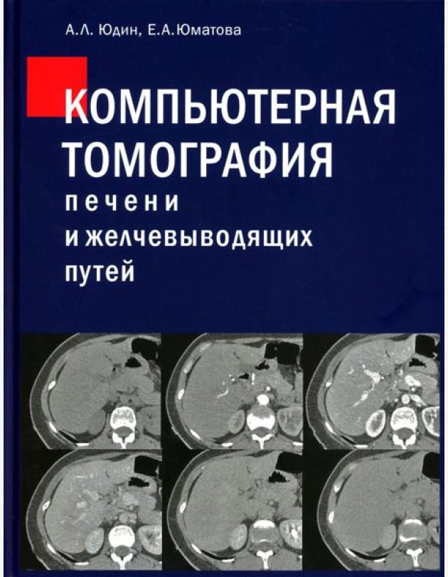 Компьютерная томография печени и желчевыводящих путей: практическое руководство