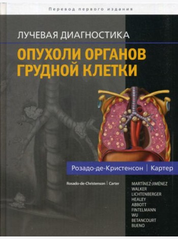 Лучевая диагностика. Опухоли органов грудной клетки