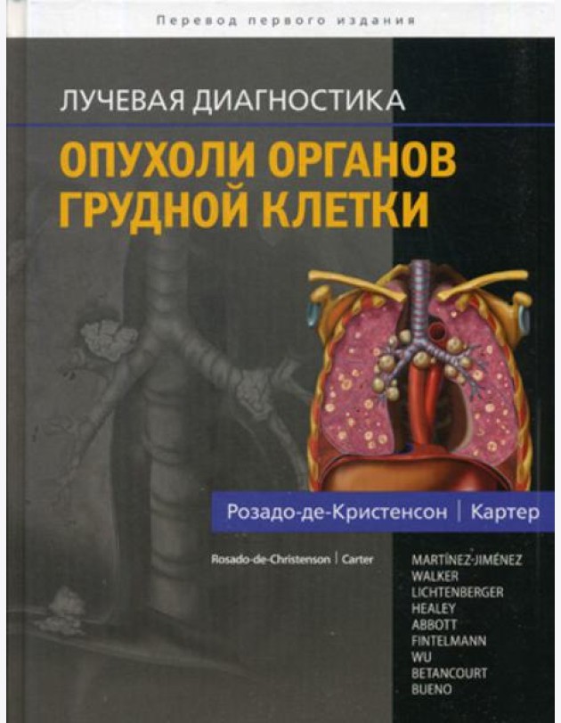 Лучевая диагностика. Опухоли органов грудной клетки