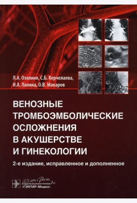 Венозные тромбоэмболические осложнения в акушерстве и гинекологии. 2-е изд., испр. и доп