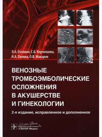 Венозные тромбоэмболические осложнения в акушерстве и гинекологии. 2-е изд., испр. и доп