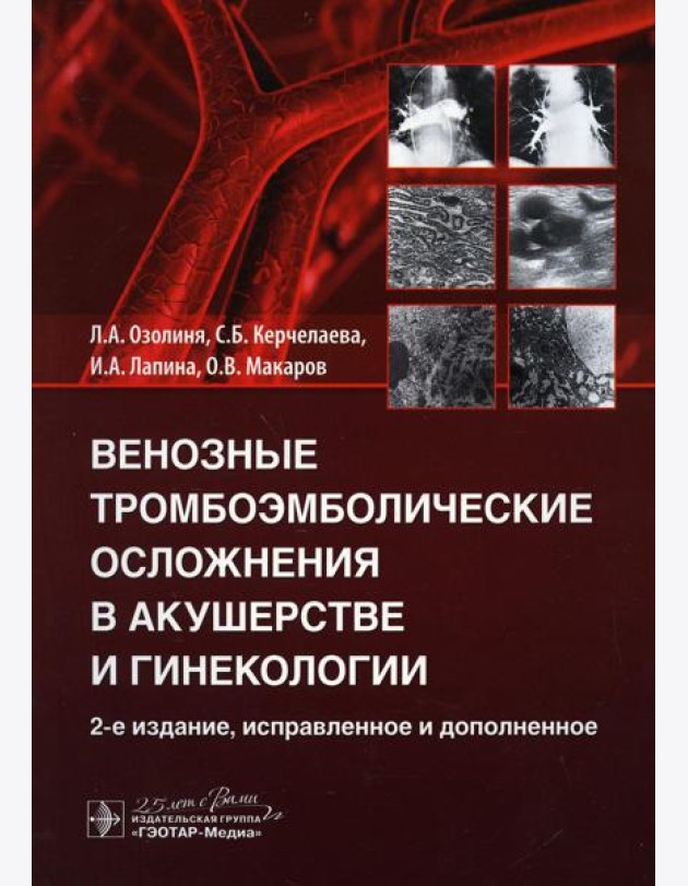 Венозные тромбоэмболические осложнения в акушерстве и гинекологии. 2-е изд., испр. и доп