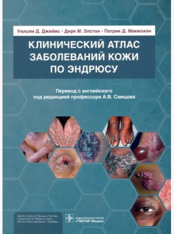 Клинический атлас заболеваний кожи по Эндрюсу