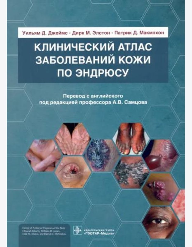 Клинический атлас заболеваний кожи по Эндрюсу