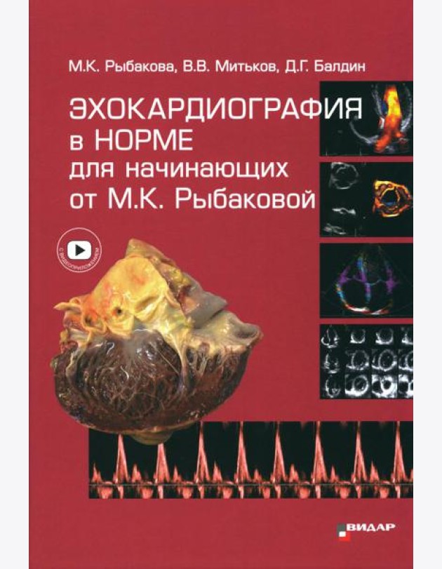 Эхокардиография в норме для начинающих от М.К. Рыбаковой