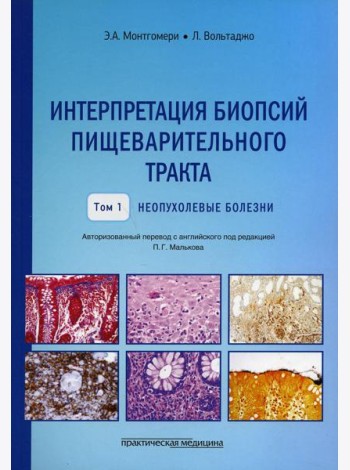 Интерпретация биопсий пищеварительного тракта. Т. 1: Неопухолевые болезни