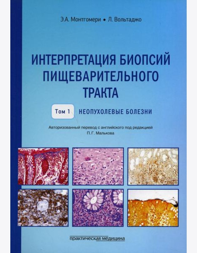 Интерпретация биопсий пищеварительного тракта. Т. 1: Неопухолевые болезни
