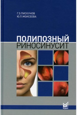 Полипозный риносинусит. 2-е изд., доп