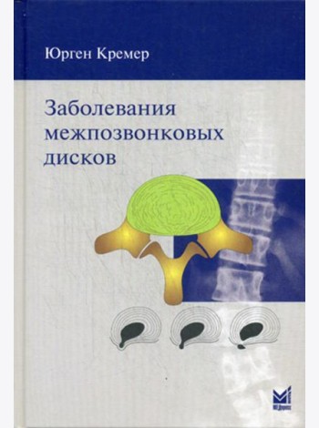 Заболевания межпозвонковых дисков. 2-е изд