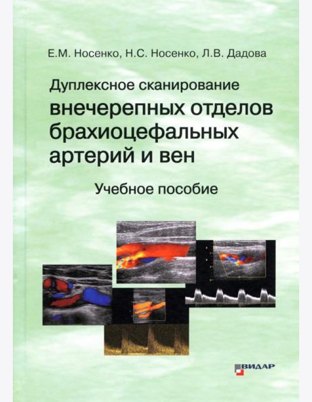 Дуплексное сканирование внечерепных отделов брахиоцефальных артерий и вен: Учебное пособие
