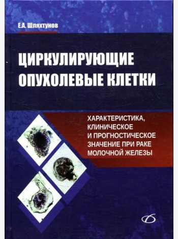 Циркулирующие опухолевые клетки: характеристика, клиническое и прогностическое значение при раке молочной железы
