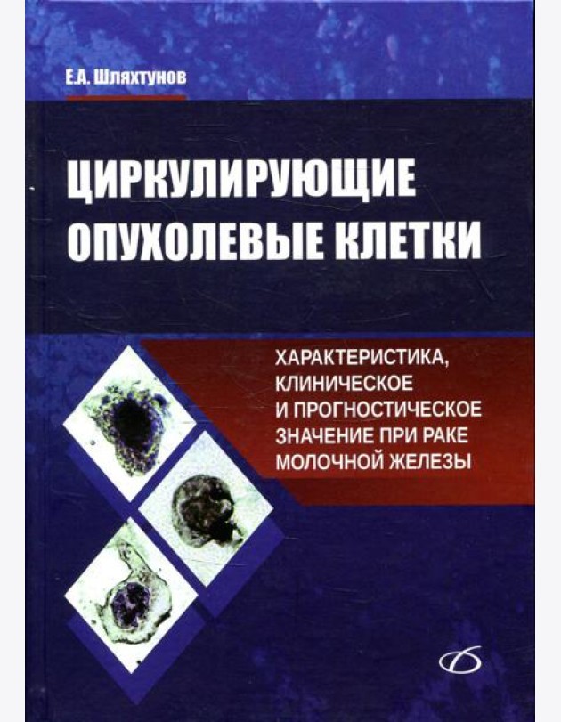 Циркулирующие опухолевые клетки: характеристика, клиническое и прогностическое значение при раке молочной железы