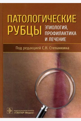 Патологические рубцы. Этиология, профилактика и лечение