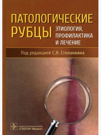 Патологические рубцы. Этиология, профилактика и лечение