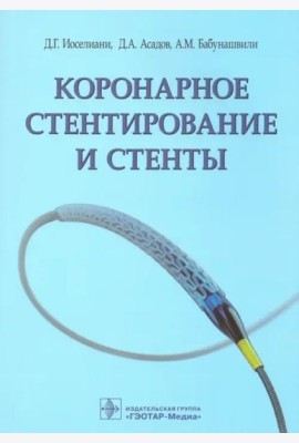 Коронарное стентирование и стенты
